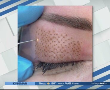 Tighten skin around your eyes with VJazzy Wellness