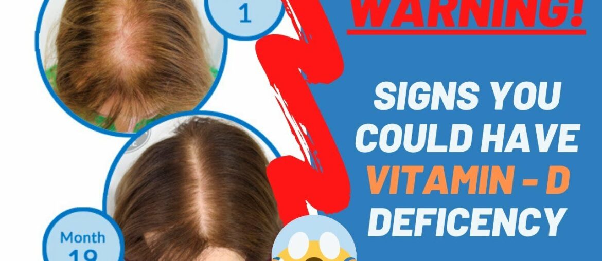 Top 11 Signs Of Vitamin D Deficiency - Must Watch | Daily Natural Cures
