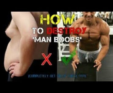 Lose Your MAN BOOBS! (IChest Fat Reduction Tips) | Gynaecomastia Problem In Men Treatment In Hindi