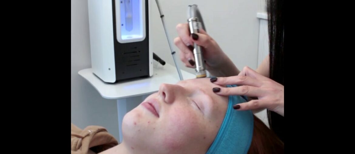 Vitamin A Infusion Peel | Mint Smilebar Skin Revision