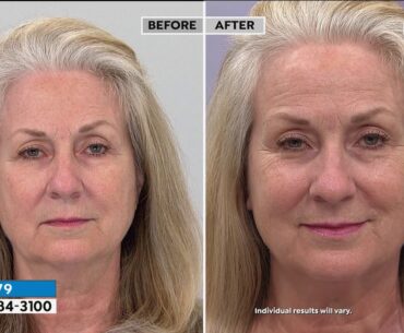 The Beauty Spy Dr. Tree Dear Loose Skin Volu 10 Cream