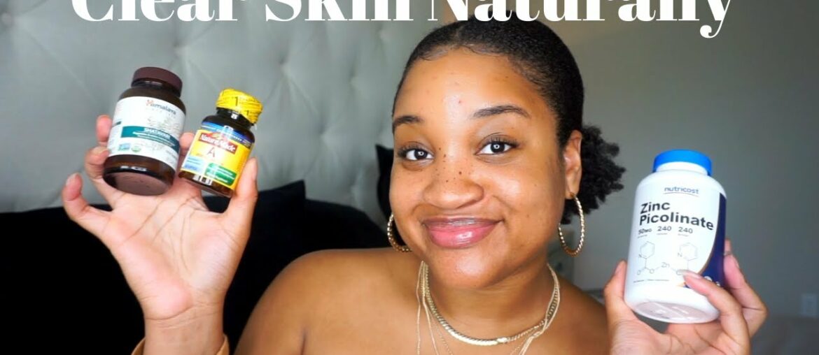 Get rid of acne with two vitamins | How to clear acne naturally fast | Chrissy Faith