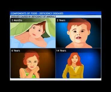 Class 6 | Science | Components of food | Deficiency Diseases