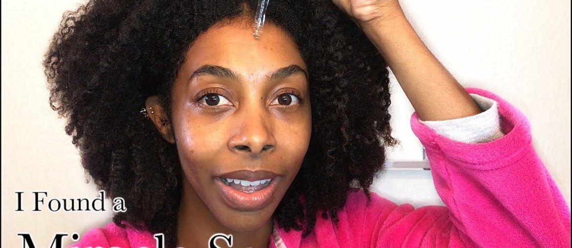 Vitamin C Serum Helped CHANGE My Skin!!! Bye-Bye Hyperpigmentation