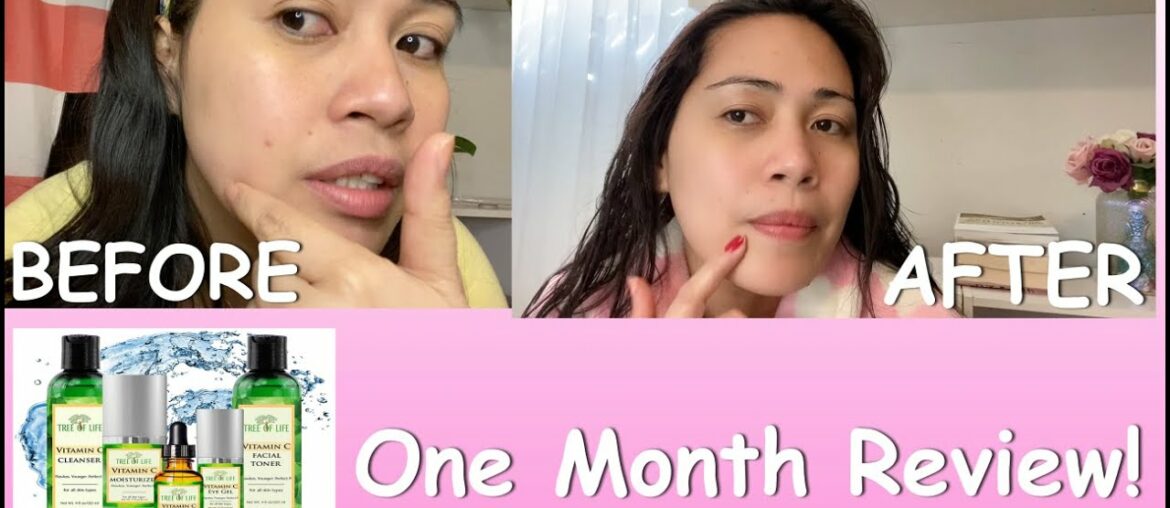 How to get rid of dark spots? | Tree of life beauty: Vitamin C review!