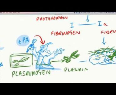 ICU Management - MATH++ Protocol Part 3