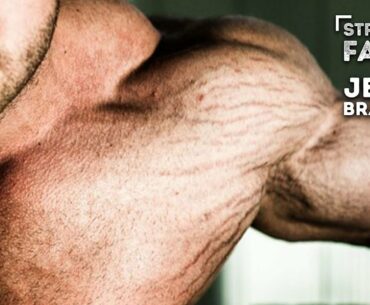 The Best Ways To Prevent And Treat Stretch Marks | Straight Facts