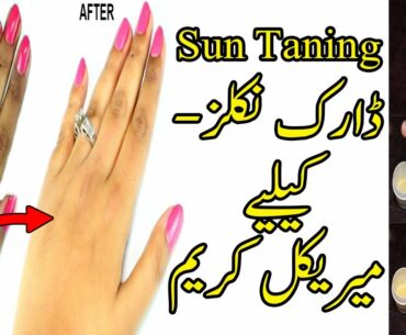 Skin Whitening Cream For Hands and Dark Knuckles | Hand Whitening Cream | beauty tips for face