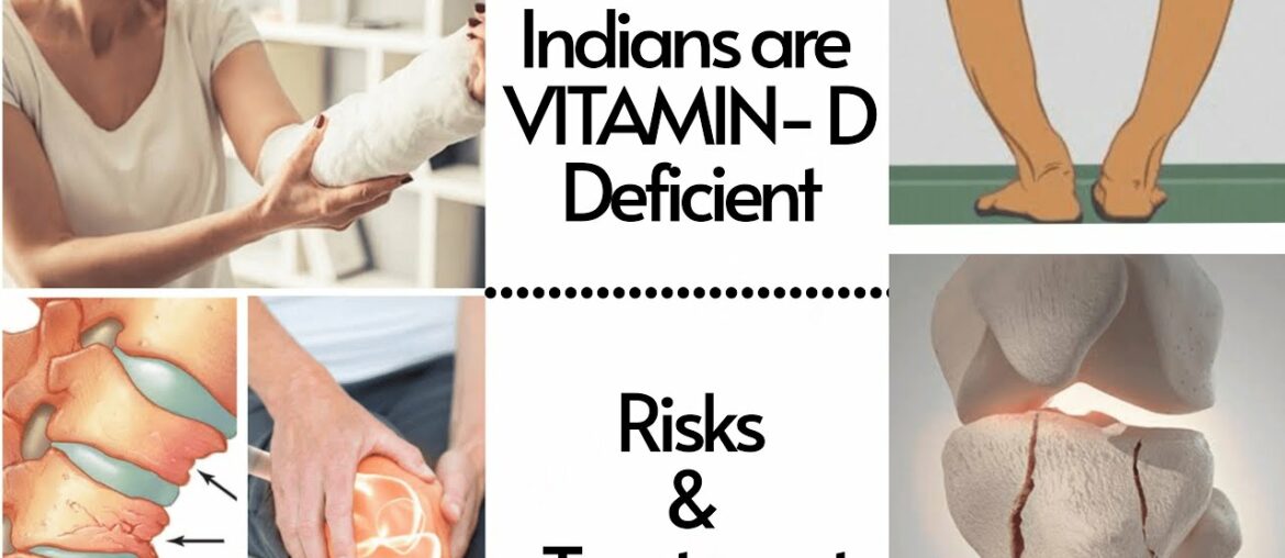 Vitamin D Deficiency & Causes| Vitamin D sources| Vitamin D Foods List| Hindi