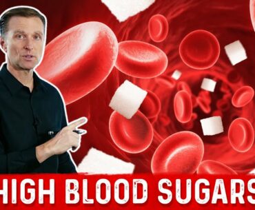How Sugar Affects Your Immune System