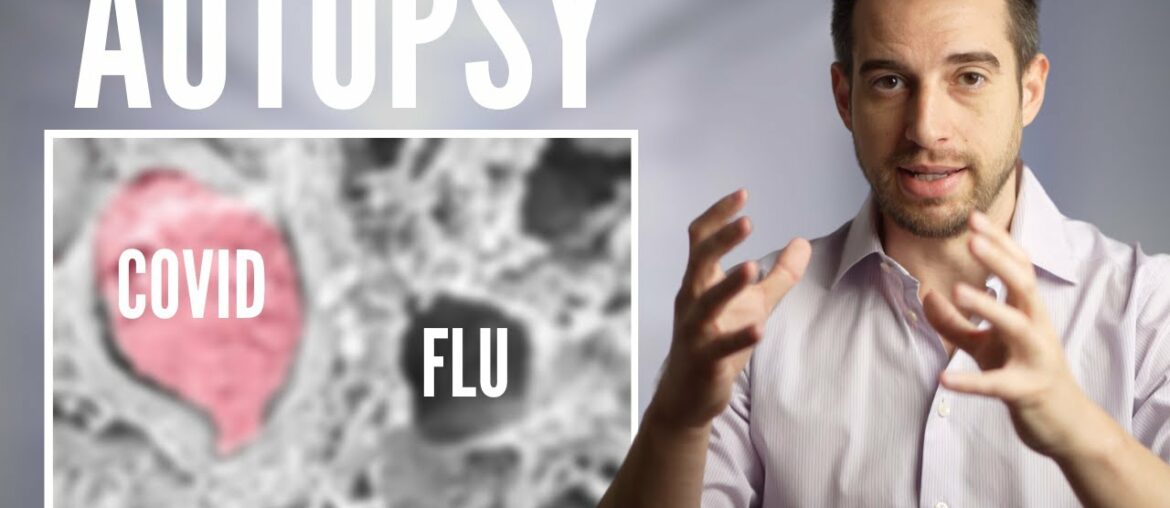 Autopsy Comparison - Coronavirus vs Flu vs Normal Lungs