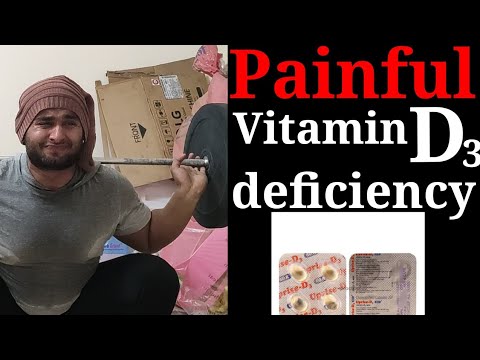 Painful vitamin D3 deficiency | vitamin D3 in depth by Shravan jr