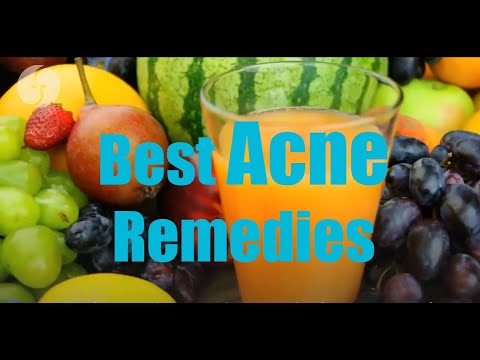 Acne Treatments Naturally | Natural Treatments for Acne | Best Acne Remedies