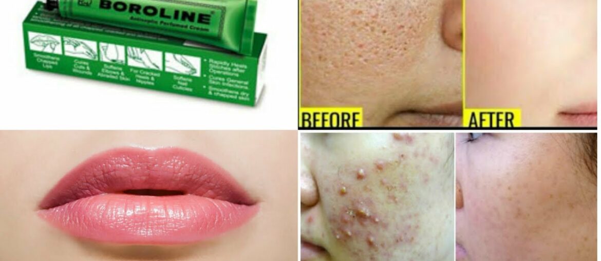 Top 10 Uses & Benefits of BOROLINE|Beauty Hacks using BOROLINE