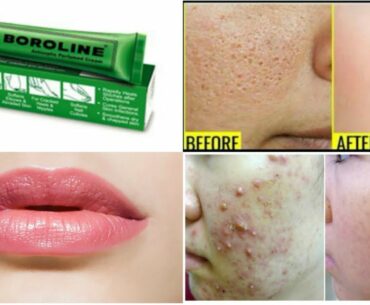 Top 10 Uses & Benefits of BOROLINE|Beauty Hacks using BOROLINE