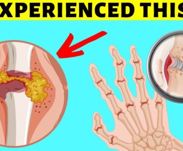 7 Signs Of Vitamin D Deficiency