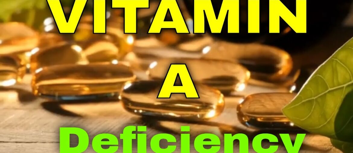 Vitamin A Deficiency Symptoms and Vitamin A Benefits | Vitamin A Foods List