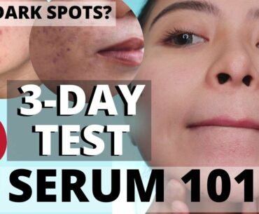 SOLUSYON SA DARK SPOTS AT PIMPLE MARKS! GARNIER VITAMIN C SERUM REVIEW!| KATH MELENDEZ
