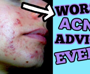 TOP WORST SKINCARE ADVICE I HAVE EVER RECEIVED! || SO YOU DON'T HAVE TO LEARN THE HARD WAY..