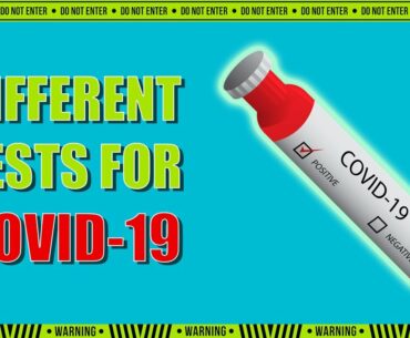 What are the different tests for coronavirus COVID-19