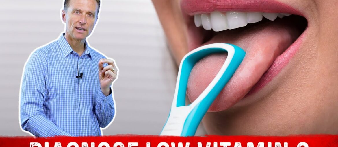 The Tongue Can Determine a Vitamin C Deficiency