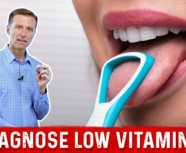 The Tongue Can Determine a Vitamin C Deficiency