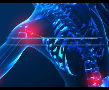The 5-Minute Rule for Chronic Joint Pain Treatment Options - Core Medical Wellness