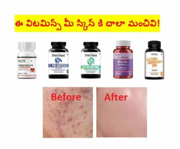 Get Young looking Clear Skin with the best Vitamins and Anti-oxidants!