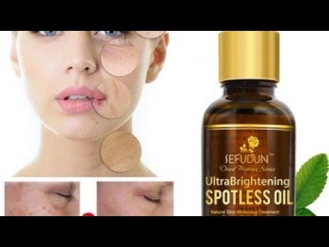 Home made vitamin c essential oil / youthful skin remedy (shahnaz husain beauty tips)