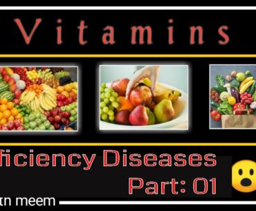 Nutritional diseases in Hindi. Deficiencies diseases. One word answer #Studywithmeem #Vitamins