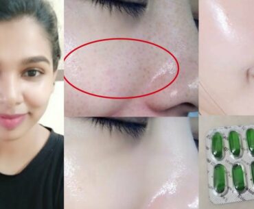 Vitamin E Oil Skin Treatment |Get Beautiful ,Spotless, glowing Skin in tamil / Top uses of vitamin e