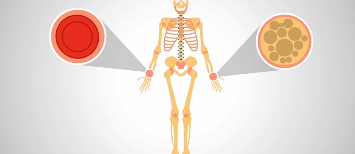 Flex-K2: What are the main benefits of Vitamin K2 Supplements?