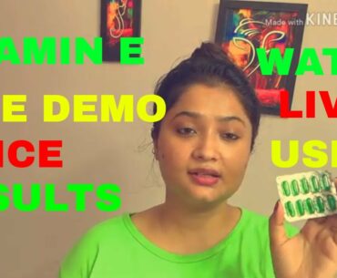 Vitamin E Oil Skin Treatment |Get Beautiful ,Spotless, glowing Skin | Anusuya chakrabarti