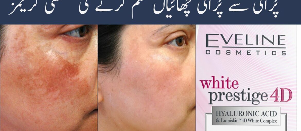Fast Skin Glowing Whitening Cream and Vitamin C Medicated Skin Whitening Cream