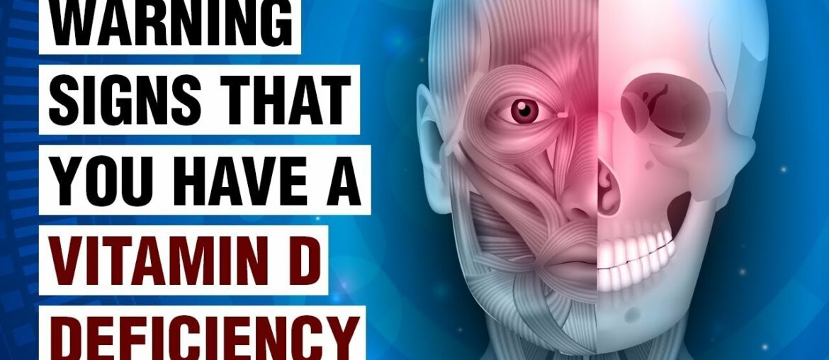 Vitamin D Deficiency. Symptoms, Causes and Treatment || 2020.