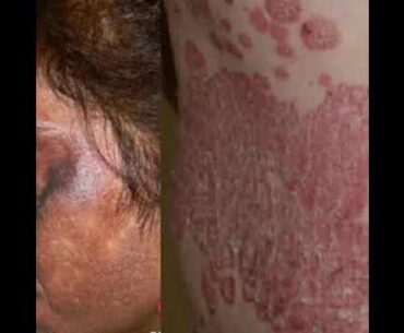 VITAMIN C DR  RASHEL WAX U QABTO KA DAWO video