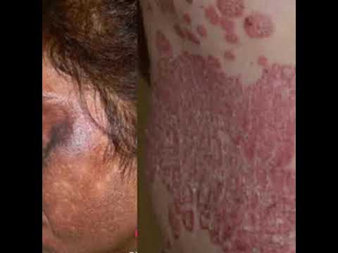 VITAMIN C DR  RASHEL WAX U QABTO KA DAWO video