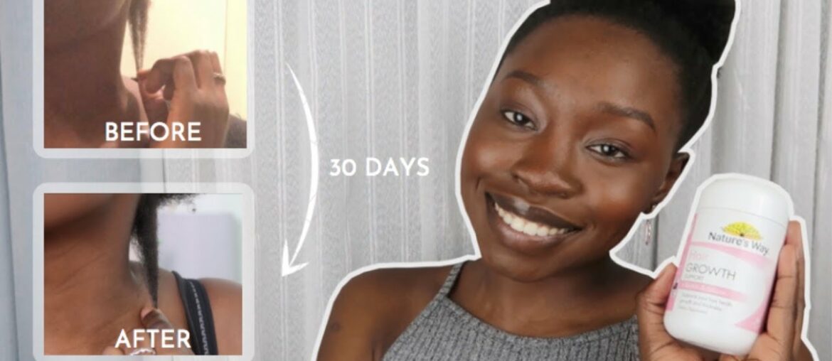 TRYING HAIR GROWTH VITAMINS FOR THE FIRST TIME *IT WORKED*| AWIEN NGOT