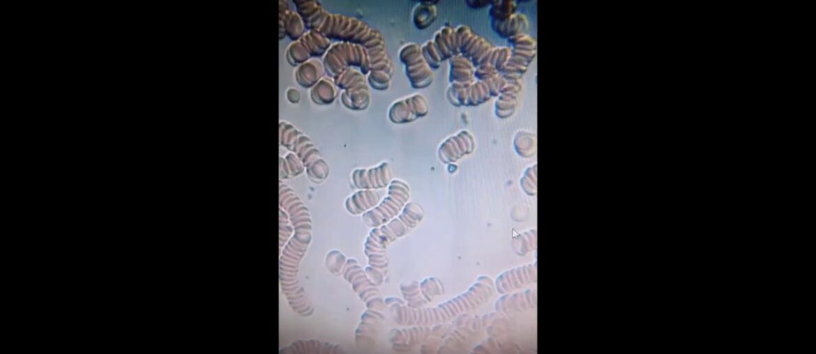 COVID-19 Why some people Immune