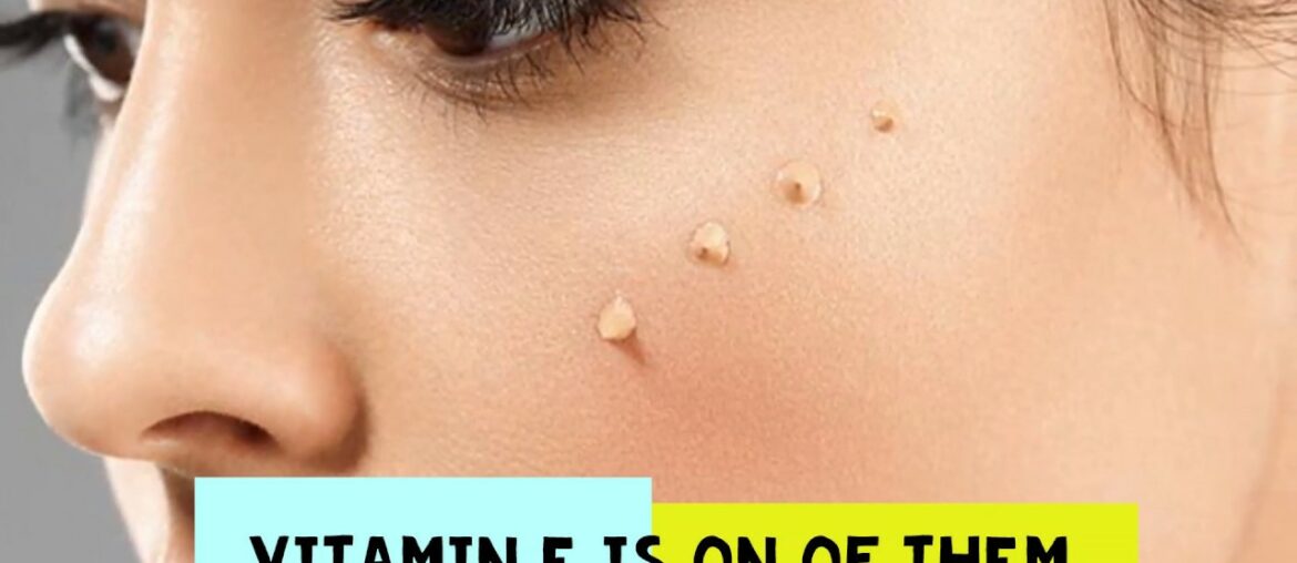 Vitamin E Capsules | EAnnatto DeltaGold | Now In India | 2019