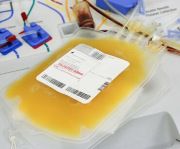 Plasma Therapy (Can Plasma Therapy Cure COVID-19 ?)