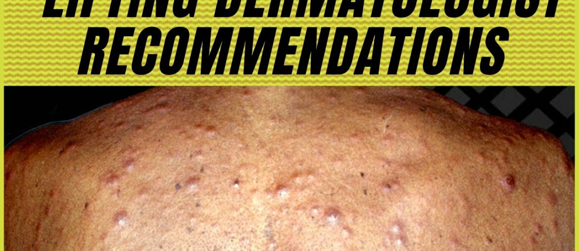 How to Prevent Acne on TRT with Supplements for Acne? Acne on Steroids Prevention