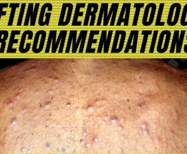 How to Prevent Acne on TRT with Supplements for Acne? Acne on Steroids Prevention