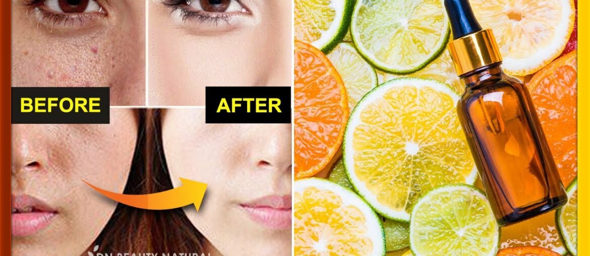 How to make vitamin C serum at home | Get glass & glow skin, spotless, skin whitening.