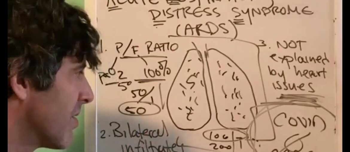 COVID19:  As requested - ARDS explained for the general public!