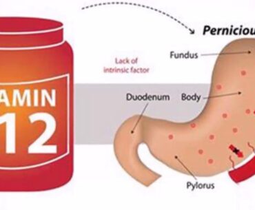 Never Ignore These Warning Signs Of Vitamin B12 Deficiency