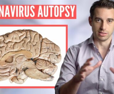 18 Coronavirus Autopsies (This is what they found in the Brain) | COVID-19