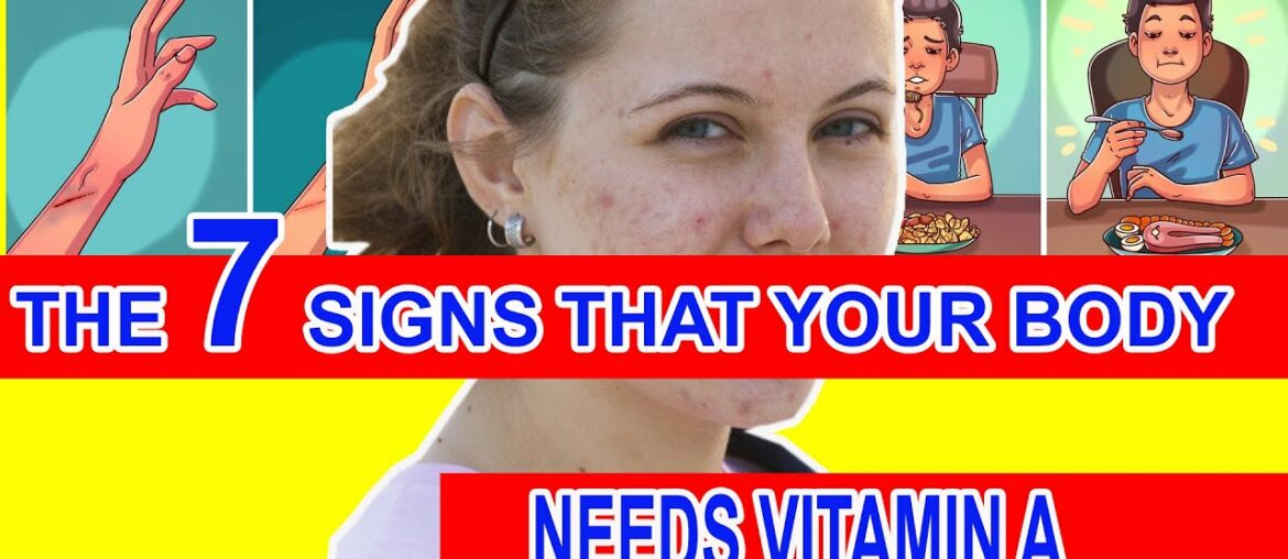 The 7 Signs That Your Body Needs Vitamin A 1