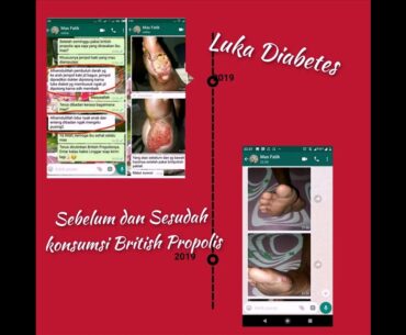 vitamin buat staminaWA;085772964720