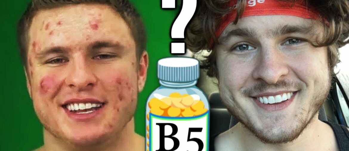 Vitamin B5: The Secret To Clearing Acne?